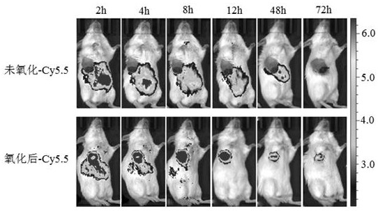 Ph-reducing double-responsive polymer embolic agent for catheter-free embolization of tumors and its synthesis