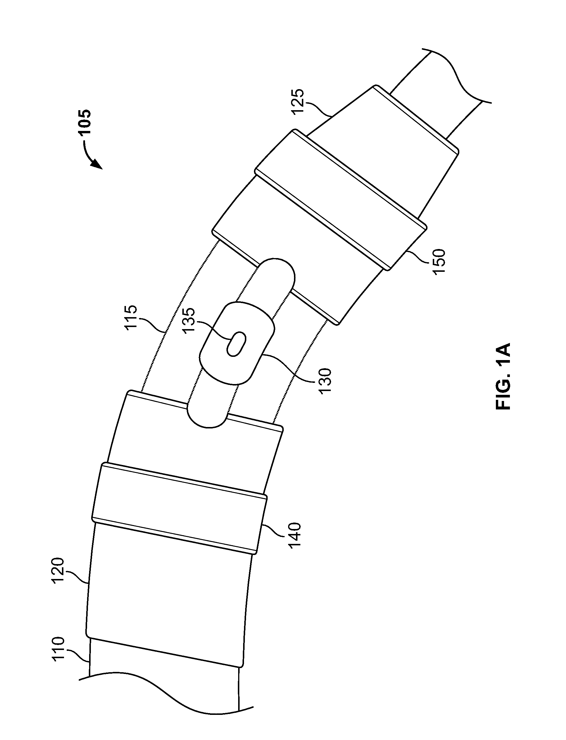 Systems and methods for treating human joints