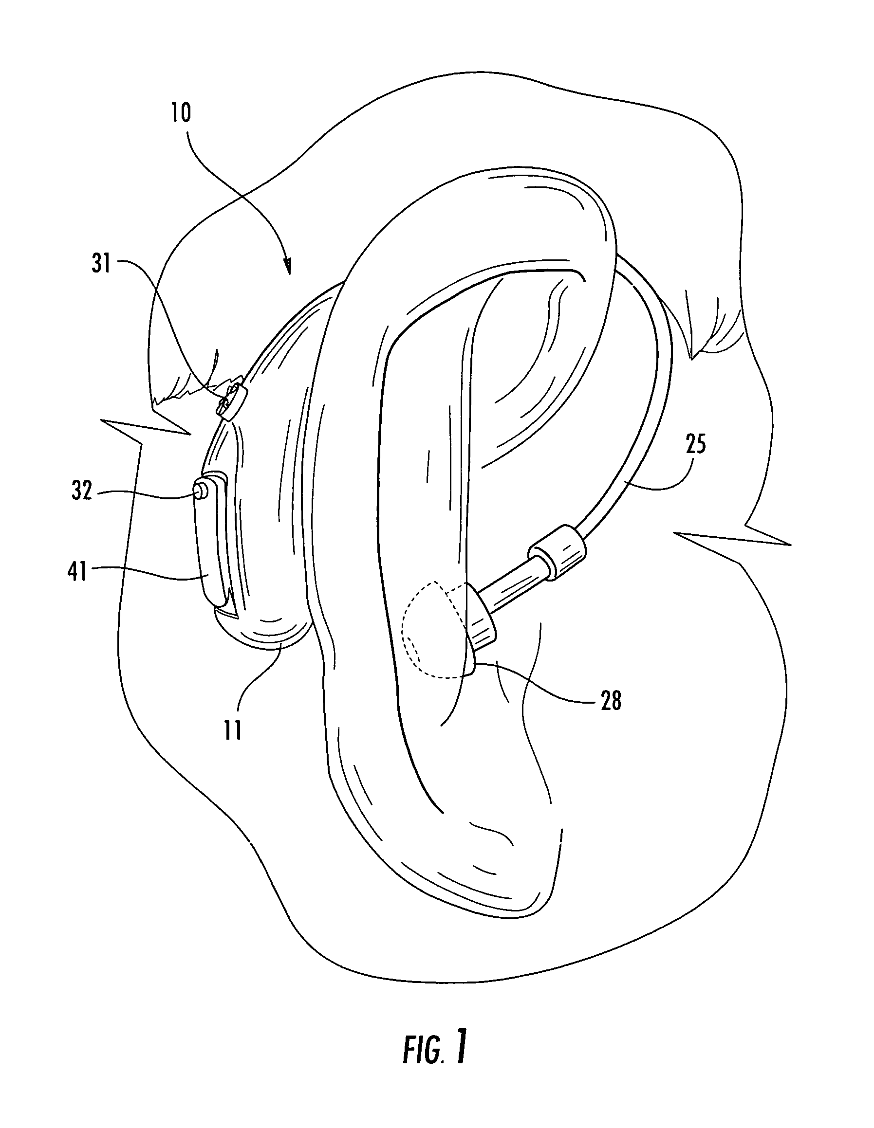 Behind-the-ear hearing aid with integrally-molded instrument case