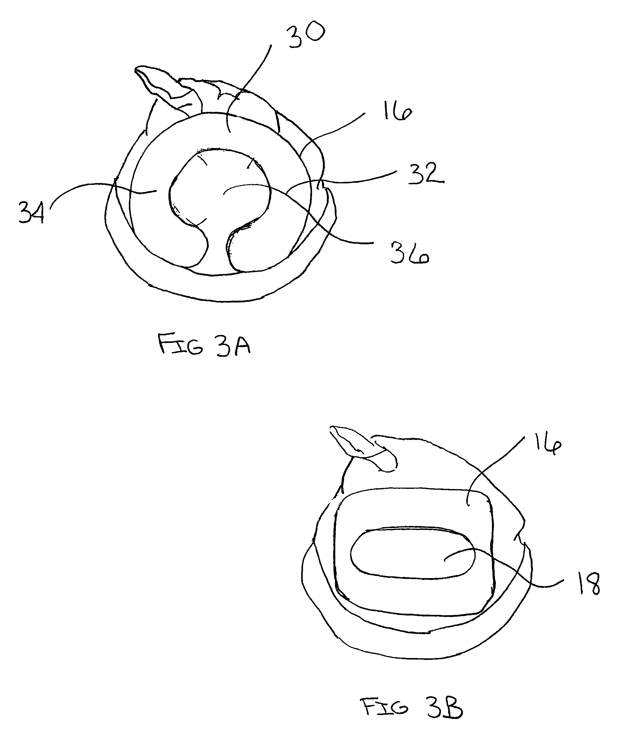 Infant hats, caps, bonnets, and hoods with padded pressure relief region