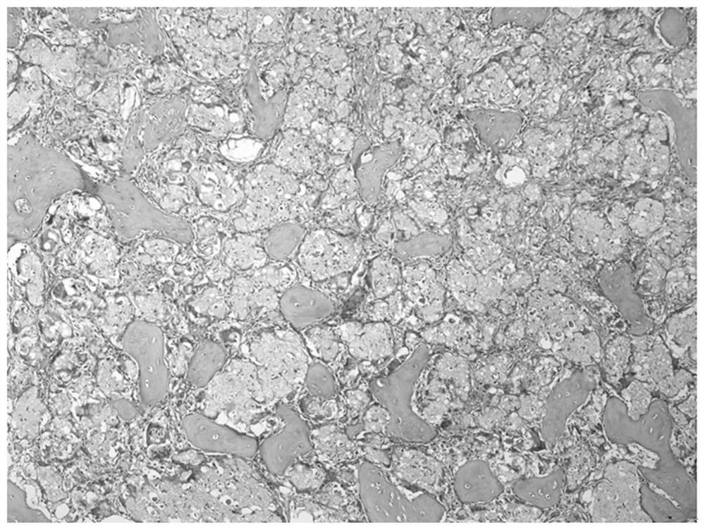 Preparation method and application of controllable degradation tissue reconstruction and repair material