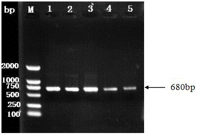 Human-derived anti-amylin antibody and preparation method thereof