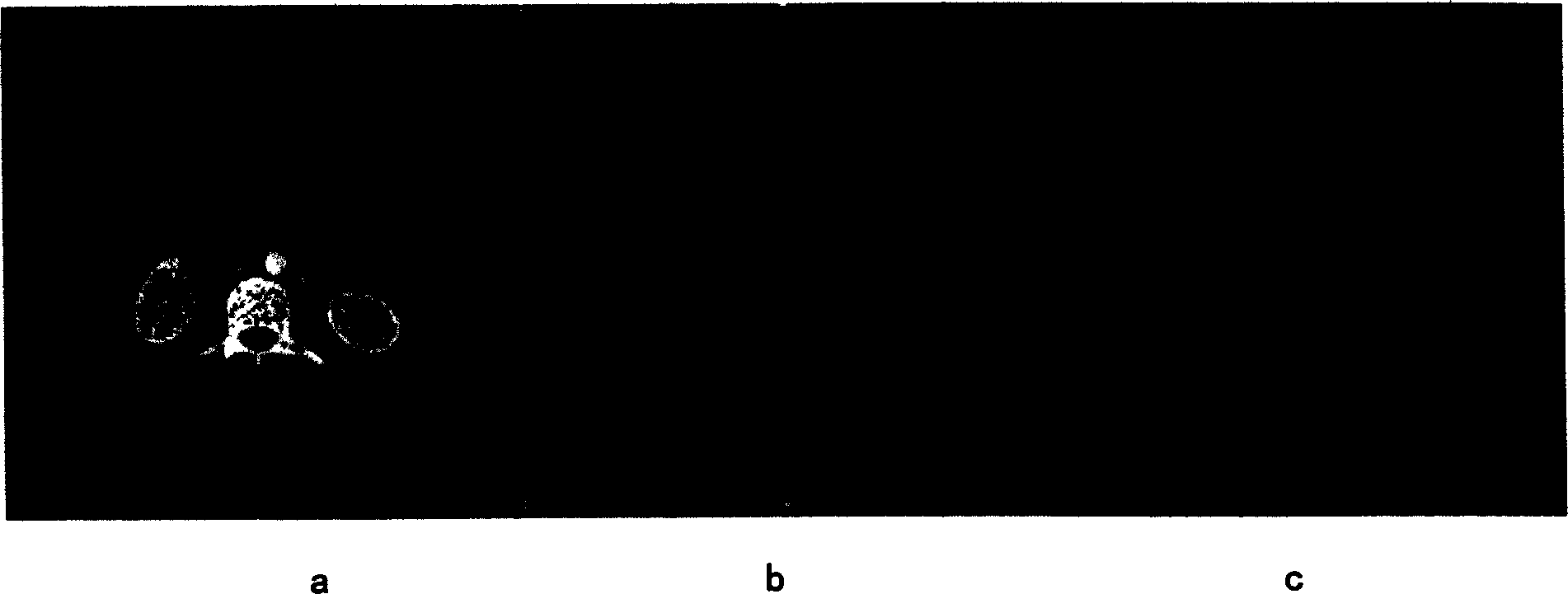 Three-dimensional dividing method for medical images