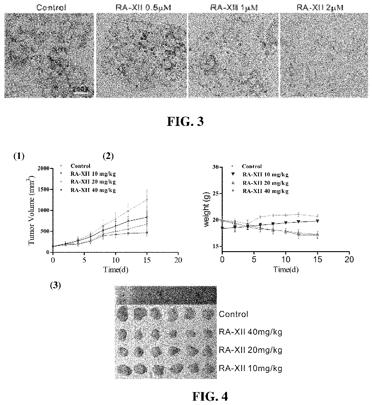 Inhibitor using plant cyclopeptide as effective component for lipid metabolic abnormalities in cancer cells and uses thereof