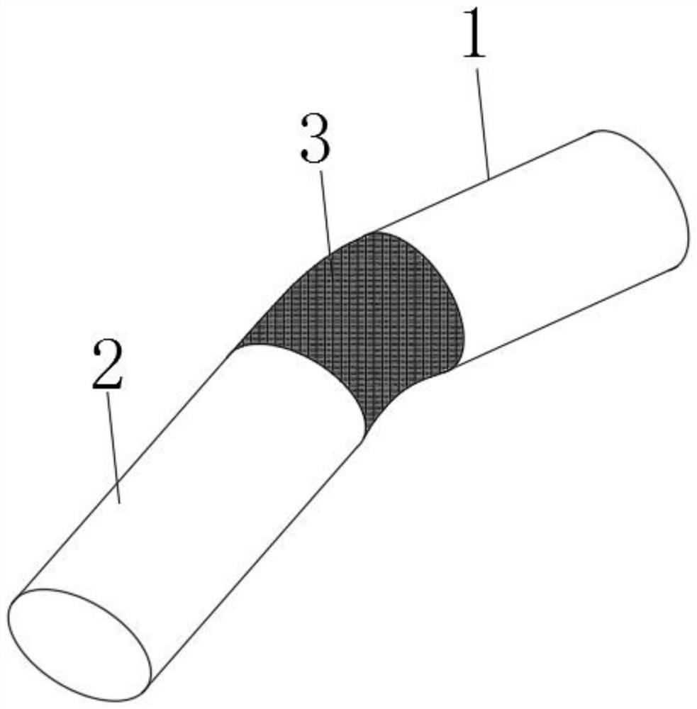 3D printed vascular stent