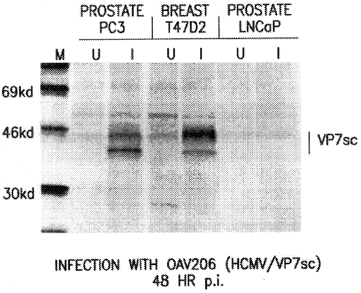 Nucleic acid delivery with ovine adenoviral vectors