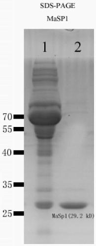 Preparation method of silk fibroin microsphere drug sustained-release carrier and application thereof