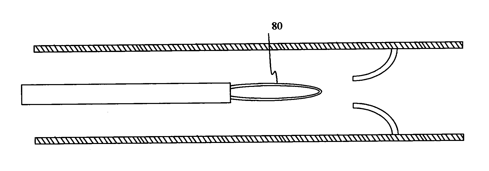 Devices and methods for treatment of venous valve insufficiency