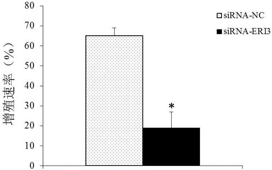 Multiple myeloma diagnosis and treatment marker and application thereof