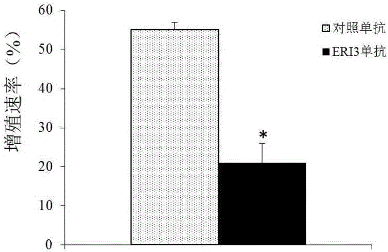 Multiple myeloma diagnosis and treatment marker and application thereof