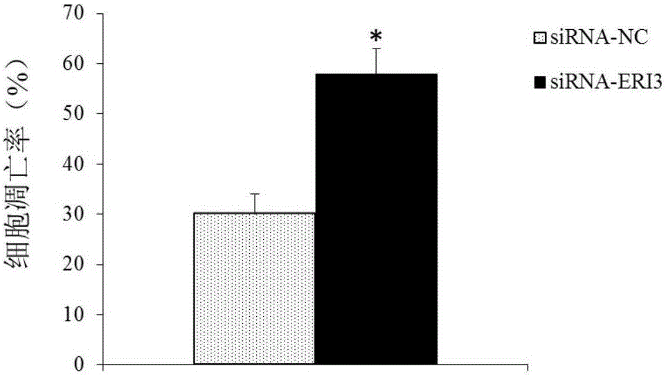 Multiple myeloma diagnosis and treatment marker and application thereof