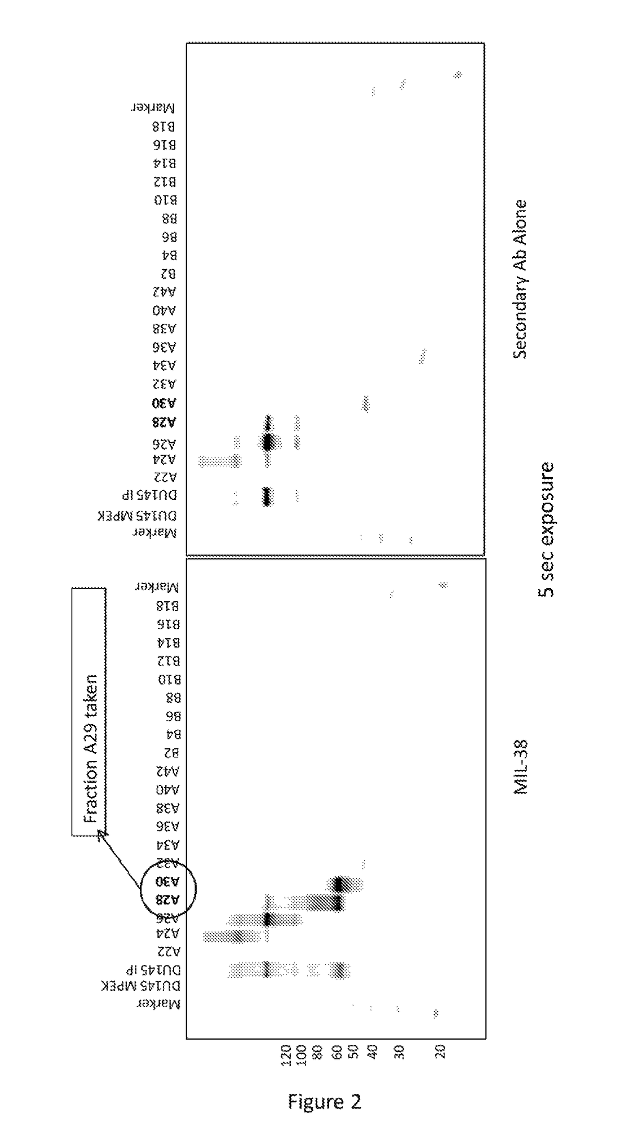 Cell surface prostate cancer antigen for diagnosis