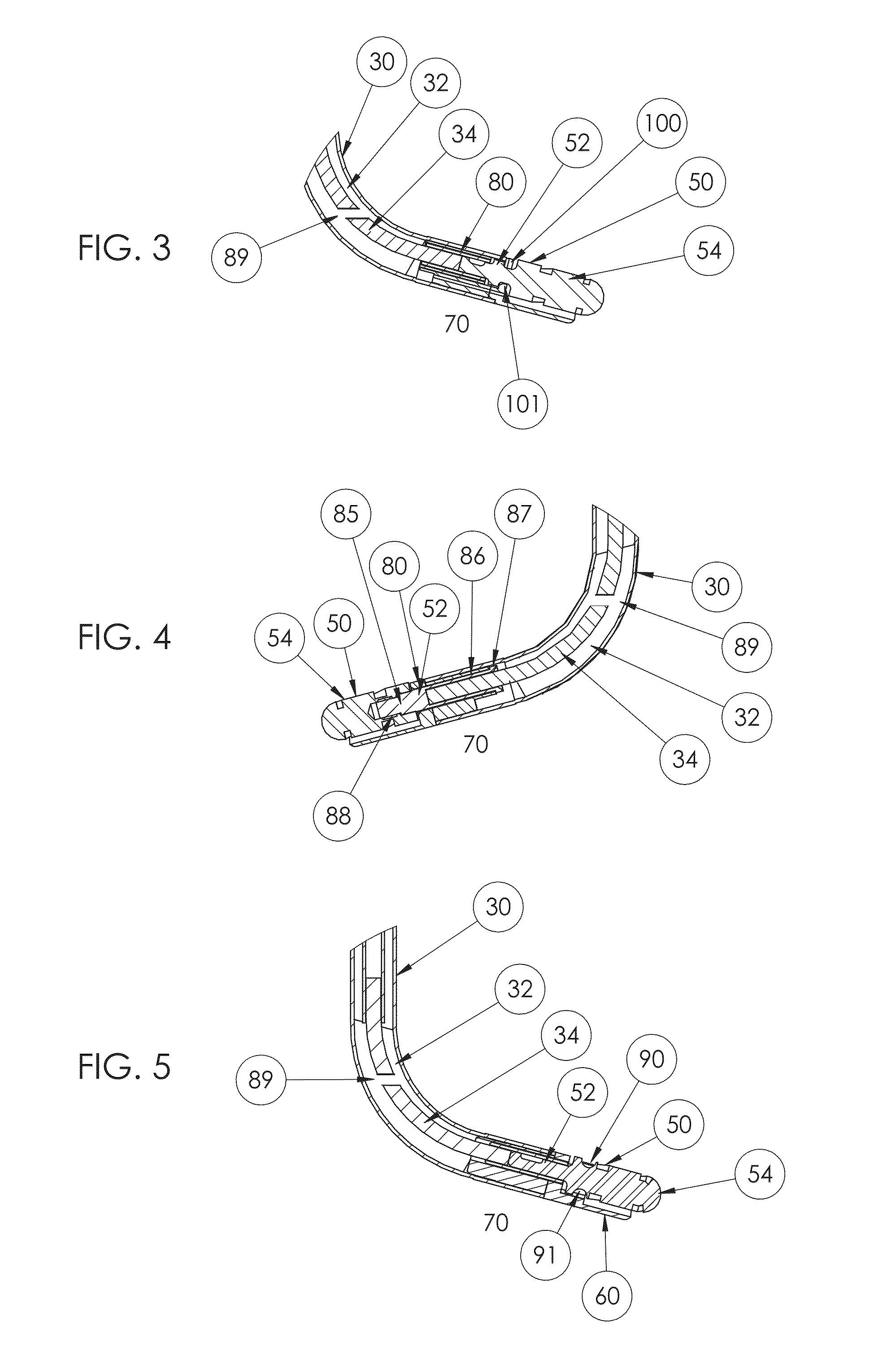 Tissue removal device