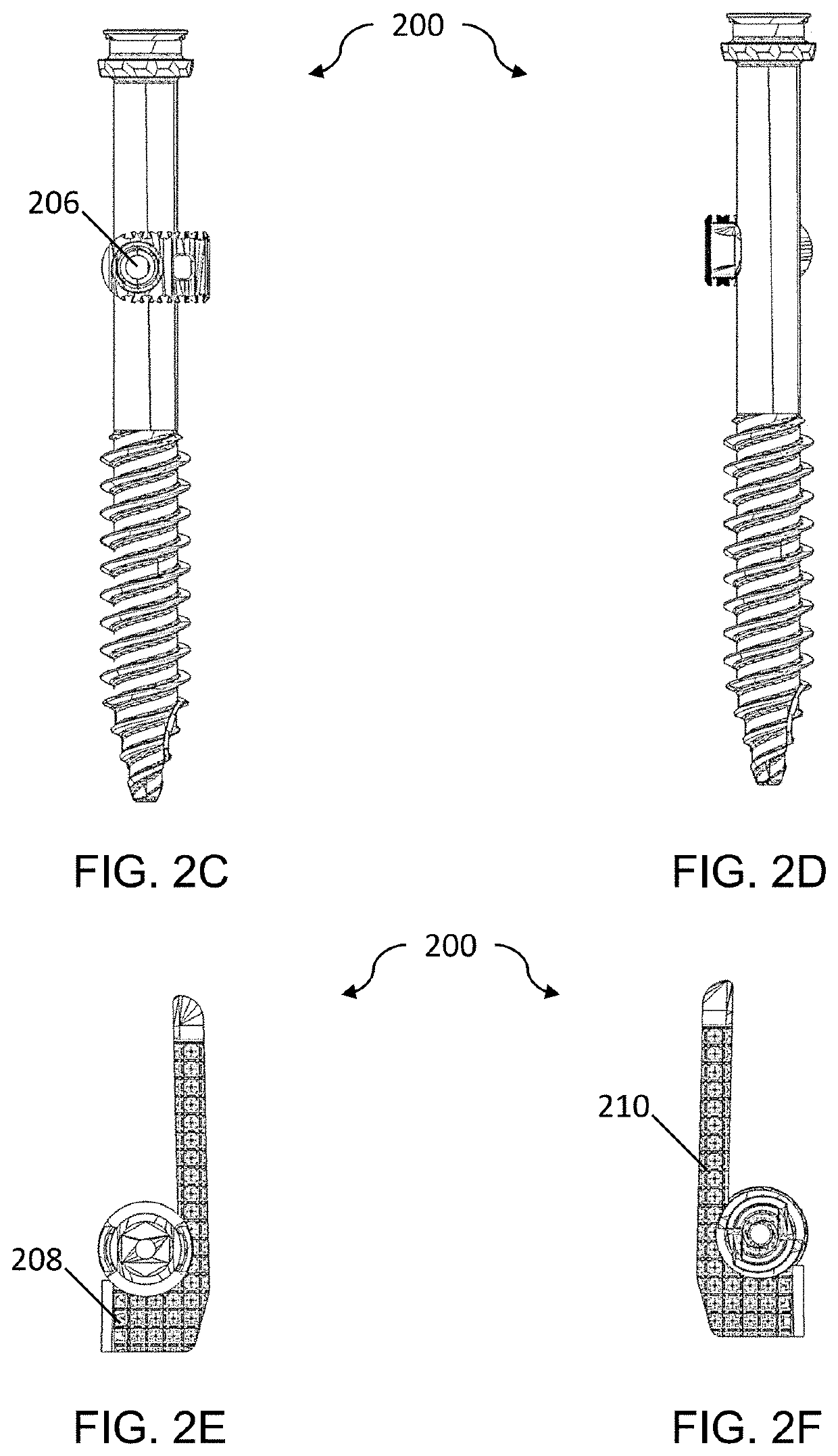 Fixation screw & method