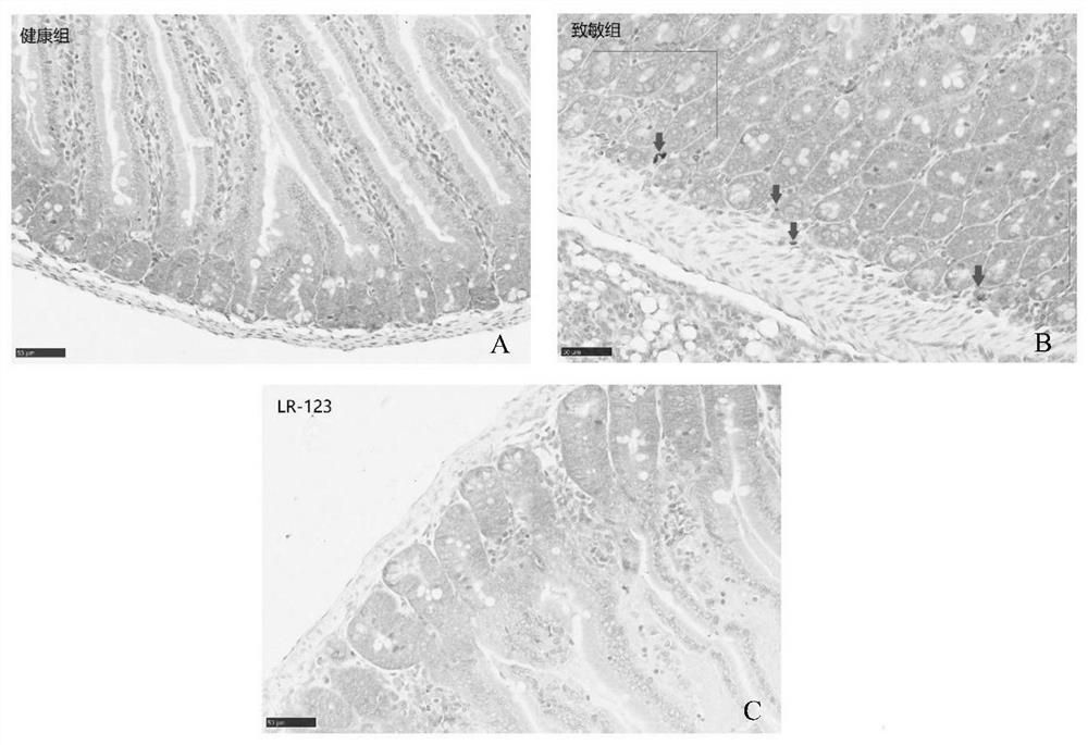 Bacterial strain with function of regulating allergic constitution and application of bacterial strain