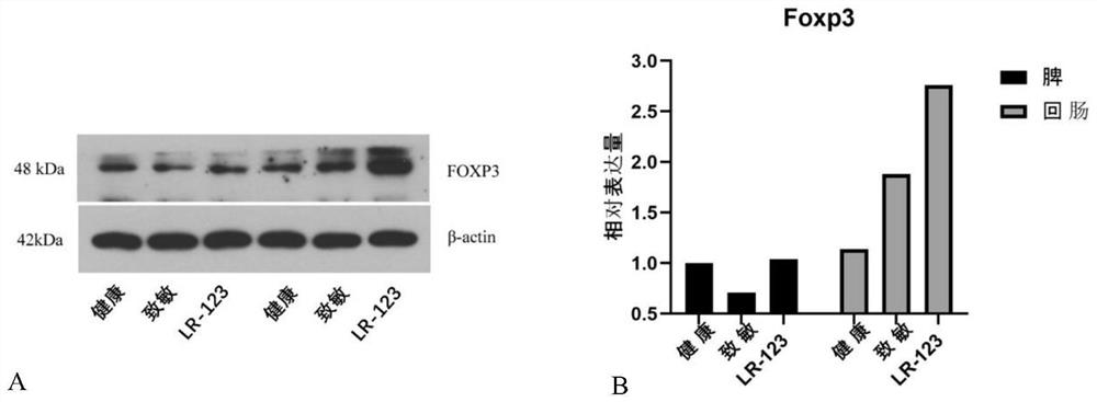 Bacterial strain with function of regulating allergic constitution and application of bacterial strain