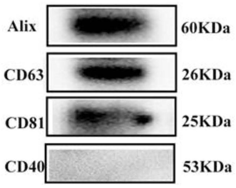 Preparation and application of milk exosome loaded icariin nano preparation