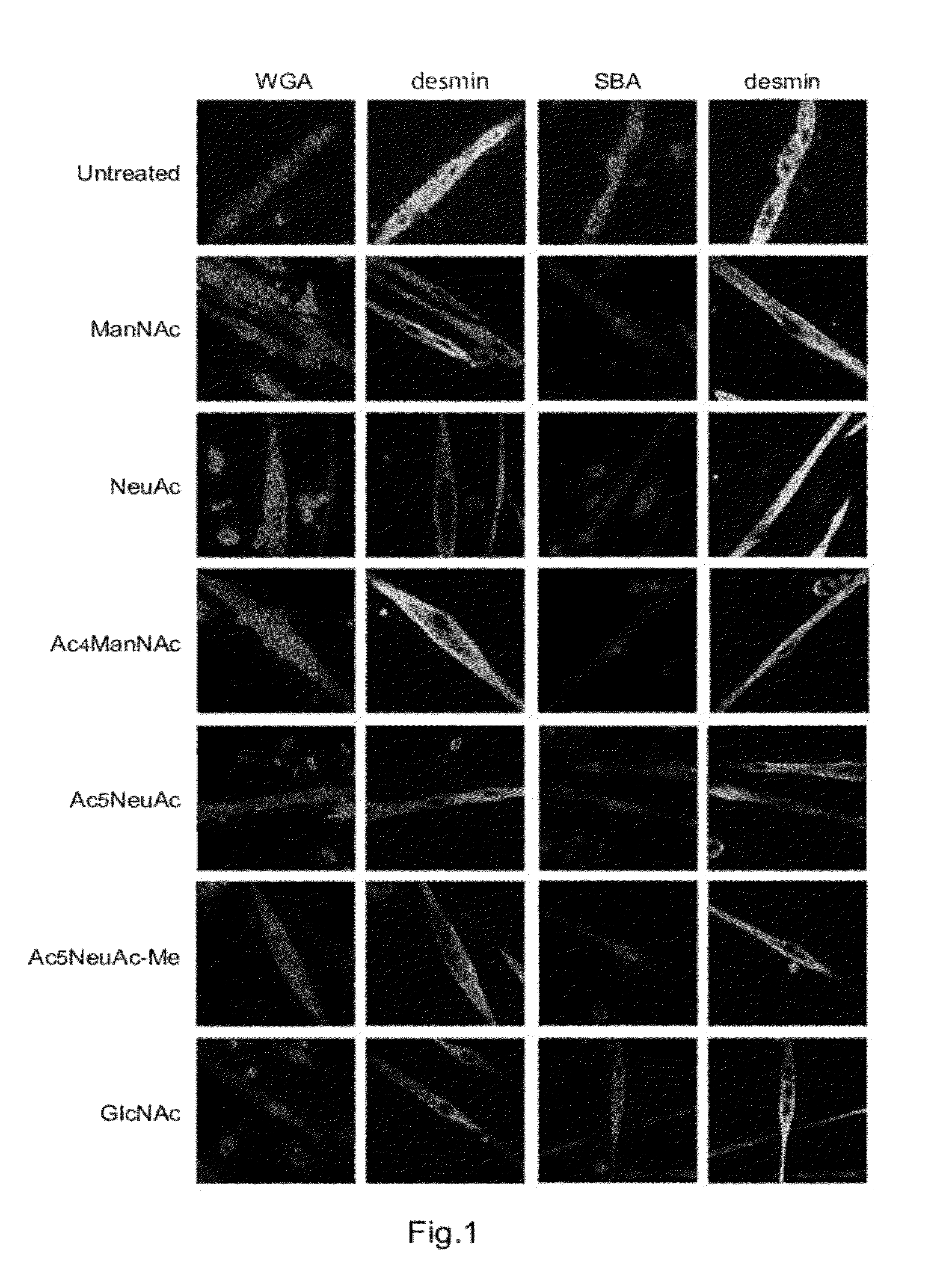 Therapeutic pharmaceutical agent for diseases associated with decrease in function of gne protein, food composition, and food additive