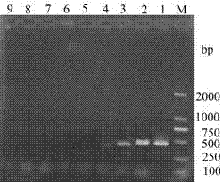 Molecular detection primer of acidovorax avenae and application thereof