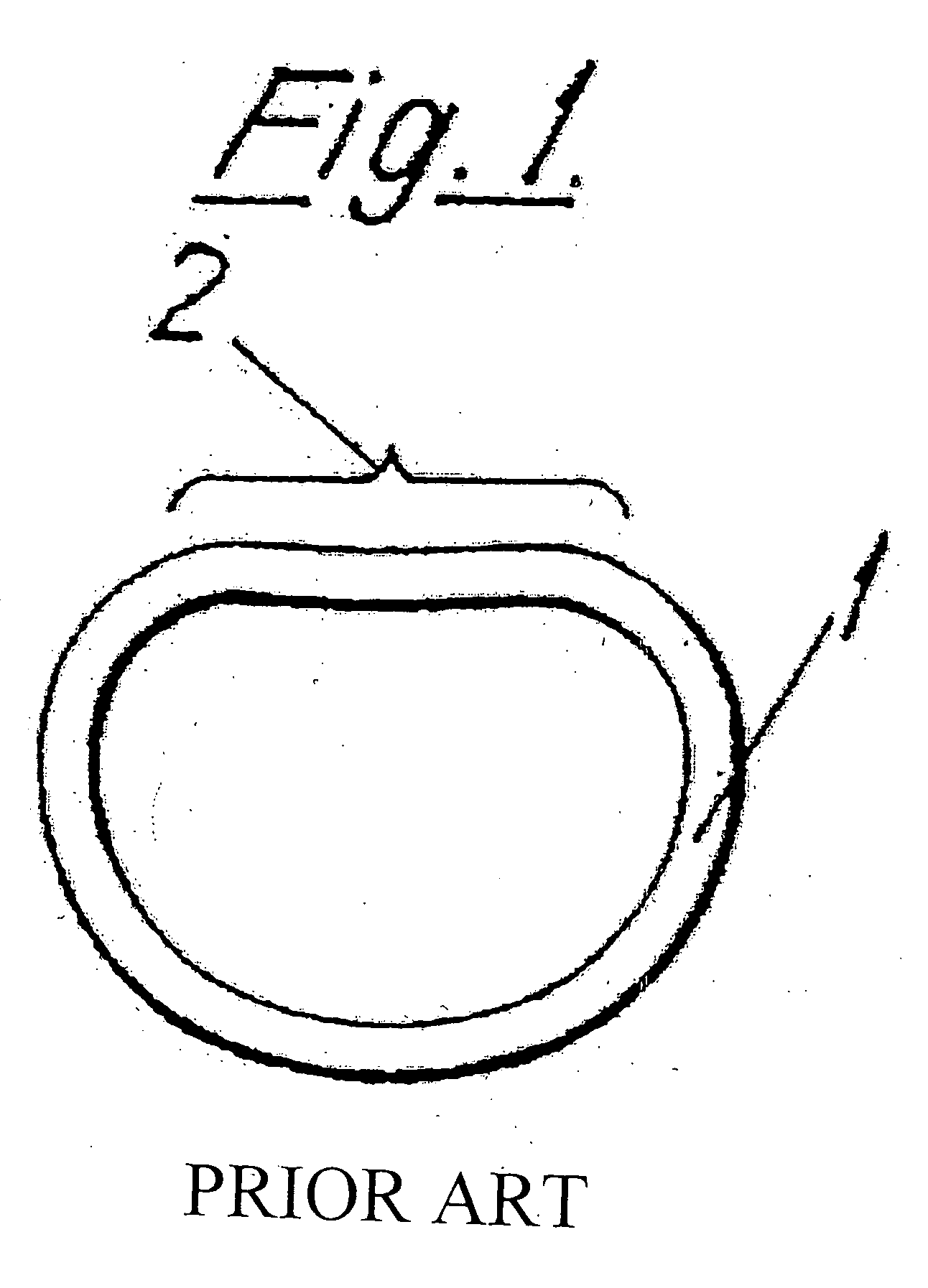 Non-planar cardiac vascular support prosthesis