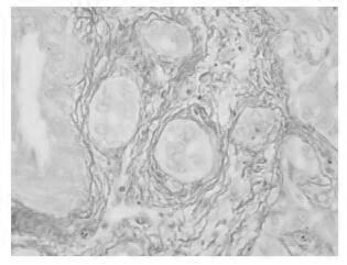 A staining method for observing collagen fibers by polarized light microscope