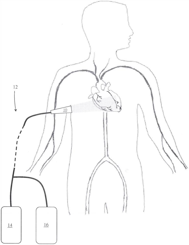 In-vitro photoacoustic scanner