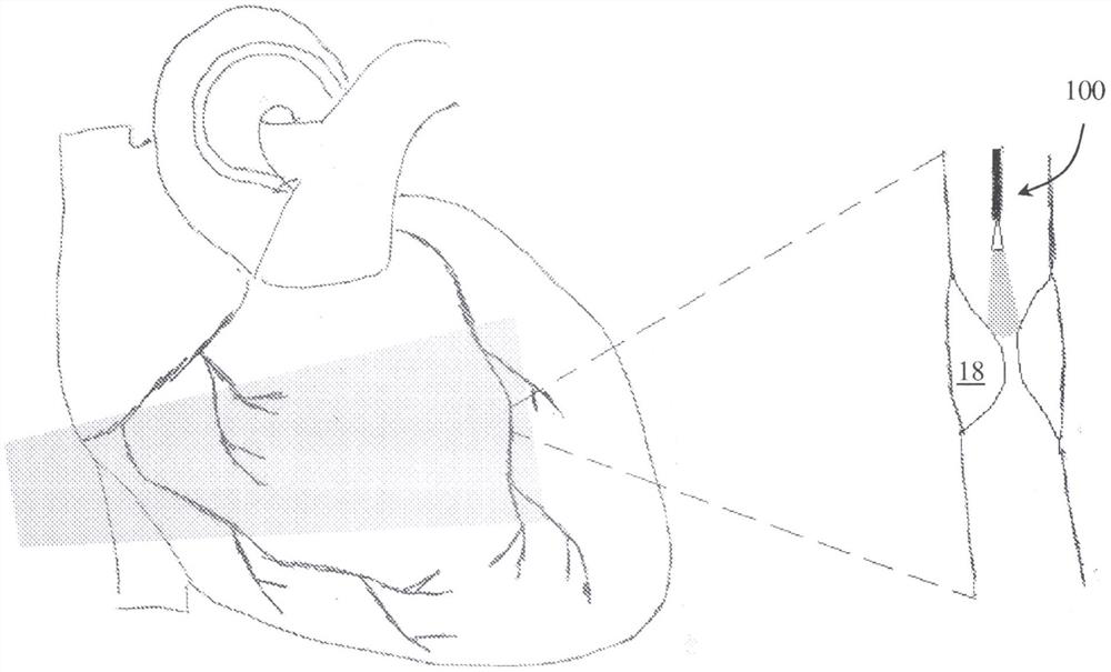 In-vitro photoacoustic scanner