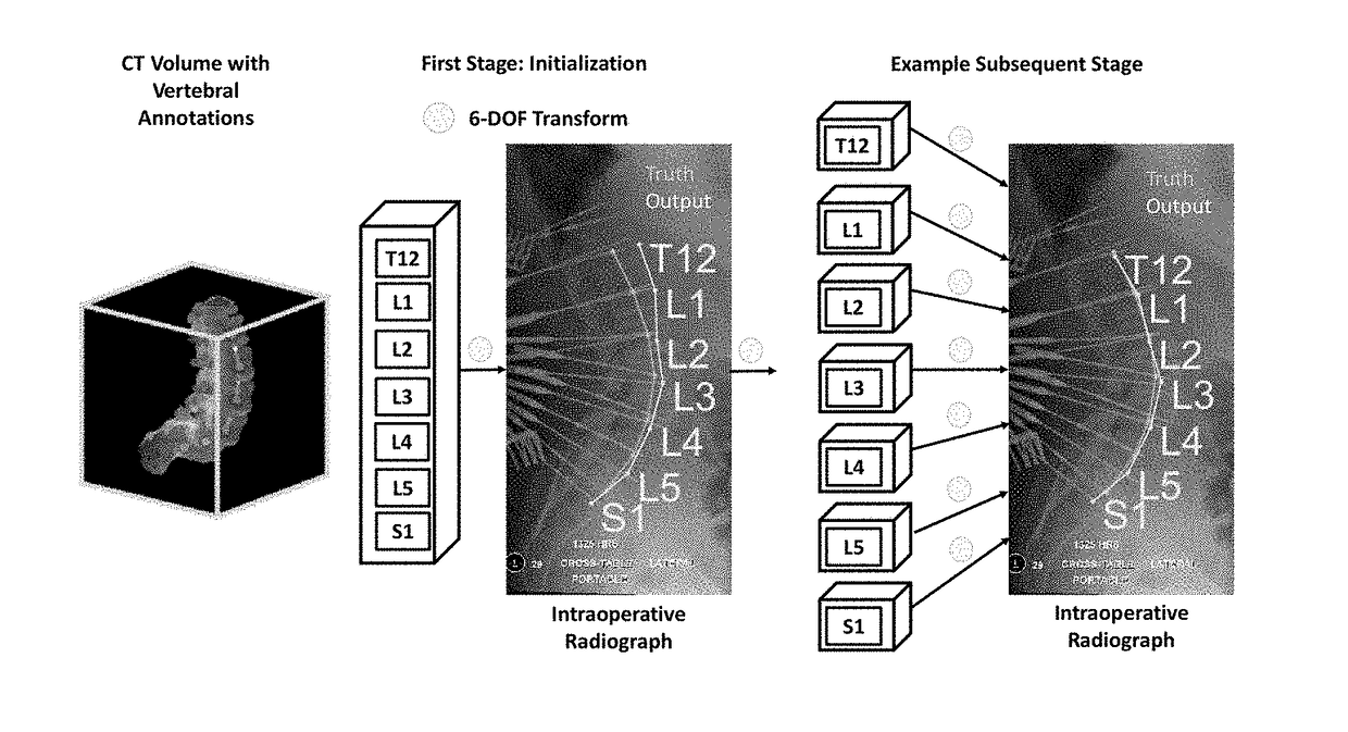 Method for deformable 3d-2d registration using multiple locally rigid registrations