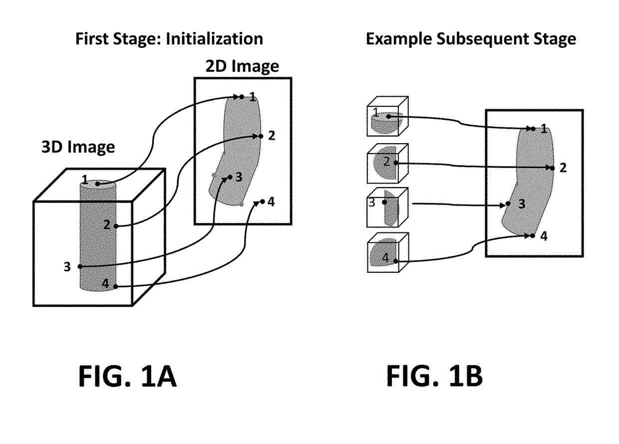 Method for deformable 3d-2d registration using multiple locally rigid registrations