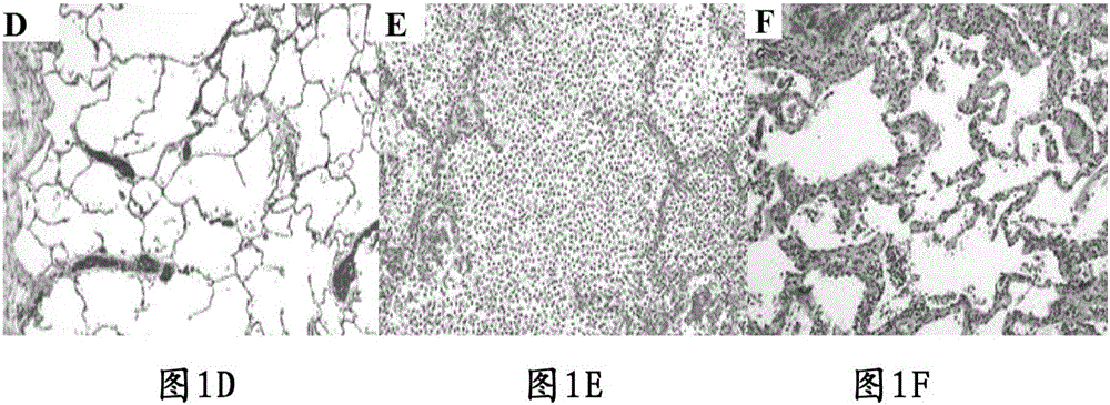 Application of piperidinium-2,3-dihydroxy-5-((2R,3R)-3,5,7-trihydroxy-4-oxochroman-2-yl)phenolate (PDTOP) in preparation of medicines for treating or preventing diseases of respiratory system