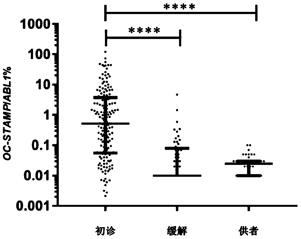 Application of OC-STAMP (osteoclast stimulatory transmembrane protein) as prognostic risk marker in evaluating multiple myeloma patients