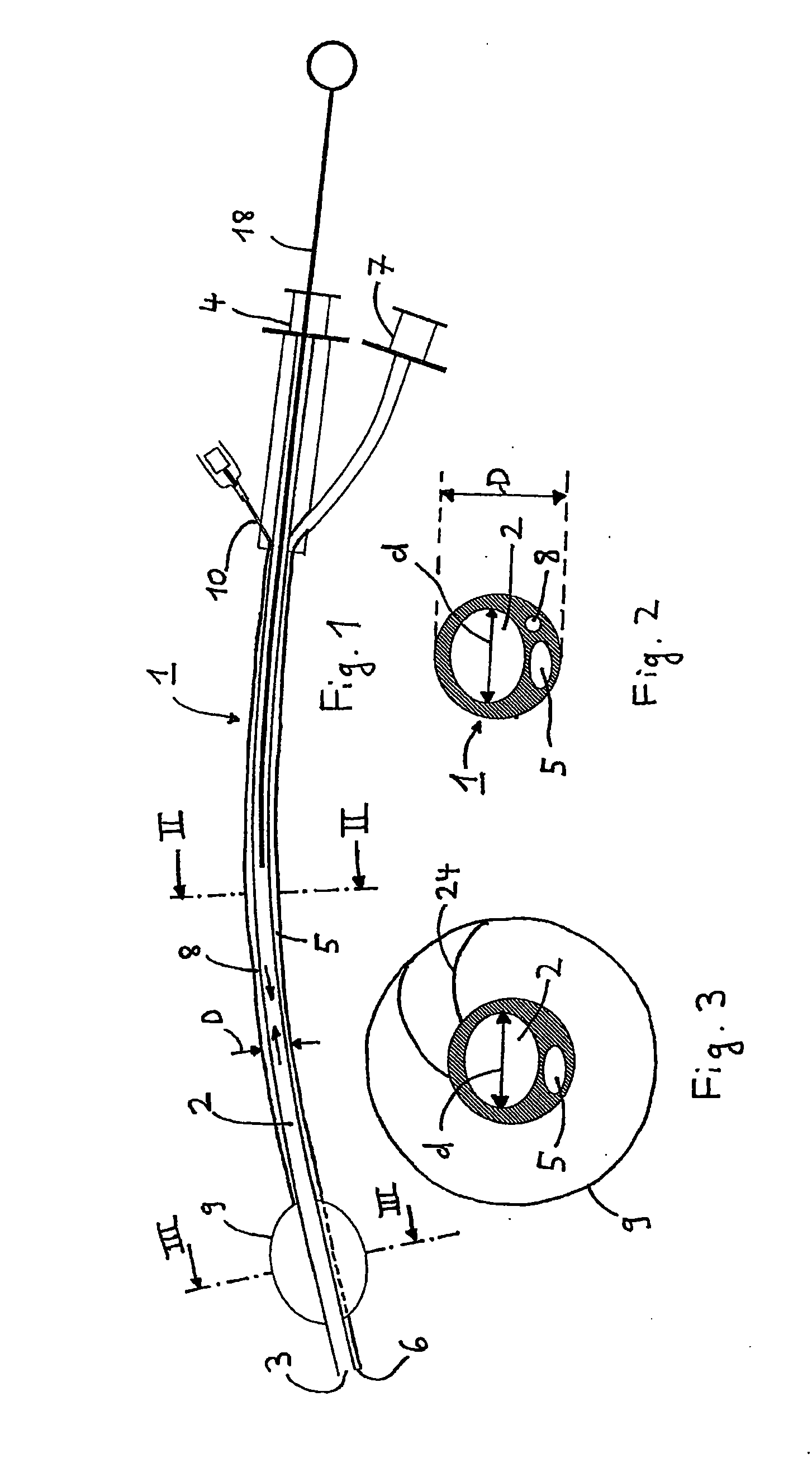 Jet ventilation catheter, in particular for ventilating a patient