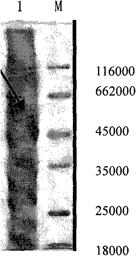 Colloidal gold labeling lap gene monoclonal antibody measuring Listeria monocytogenes kit