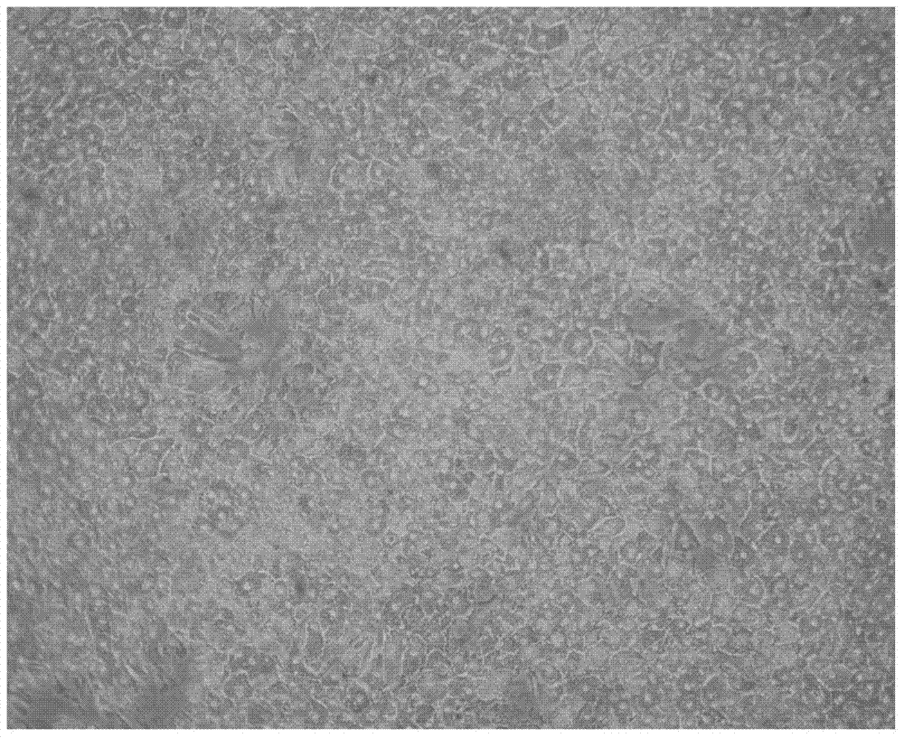 Method for separating and culturing primary chicken hepatocytes