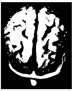 Craniocerebral model and preparation method and application thereof