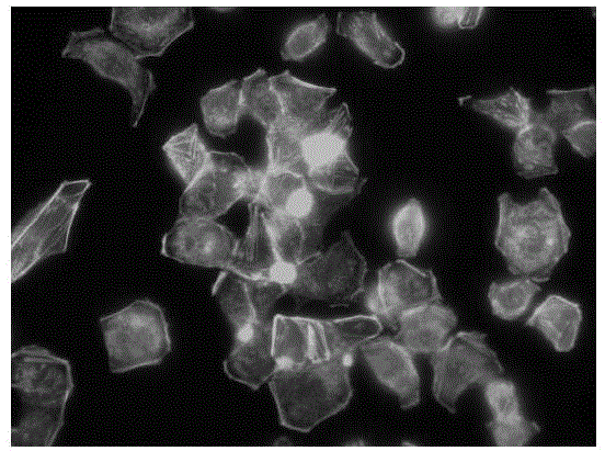 Application of toremifene citrate in preparation of medicines for inhibiting tumor cell metastasis and diffusion