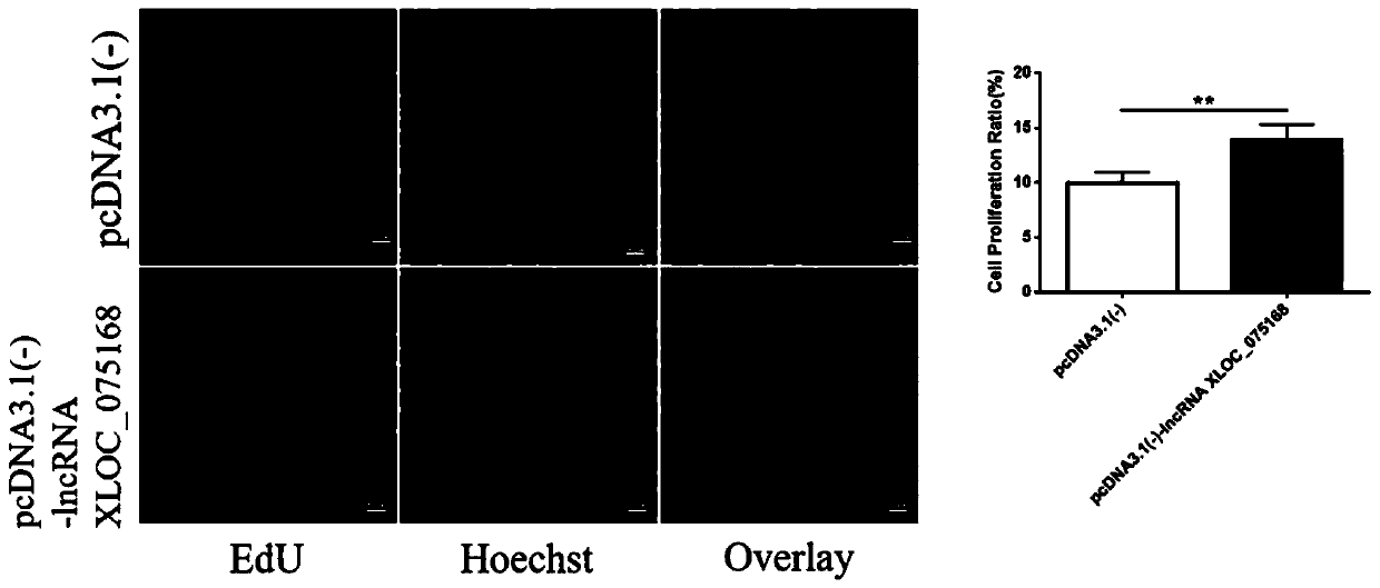 Application of LncRNA XLOC_075168 to preparation of medicines for promoting angiogenesis