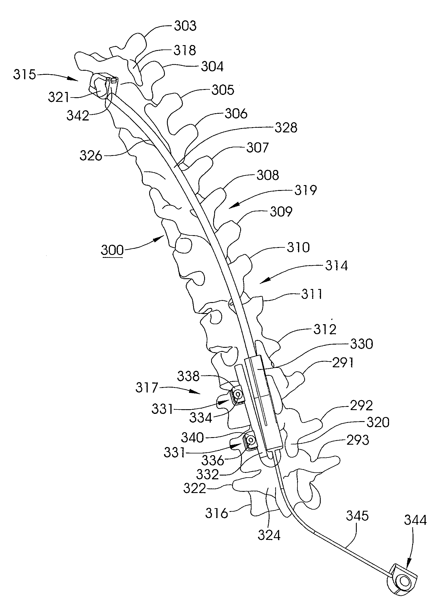 Skeletal manipulation system