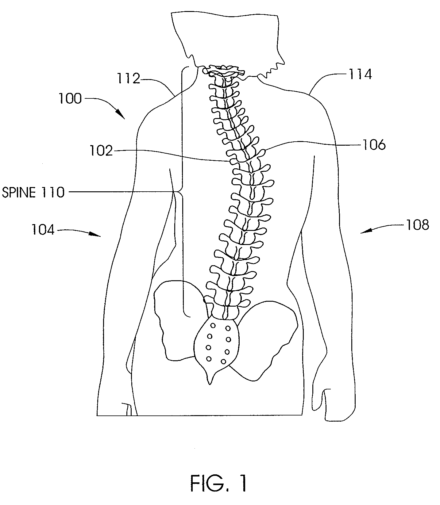 Skeletal manipulation system