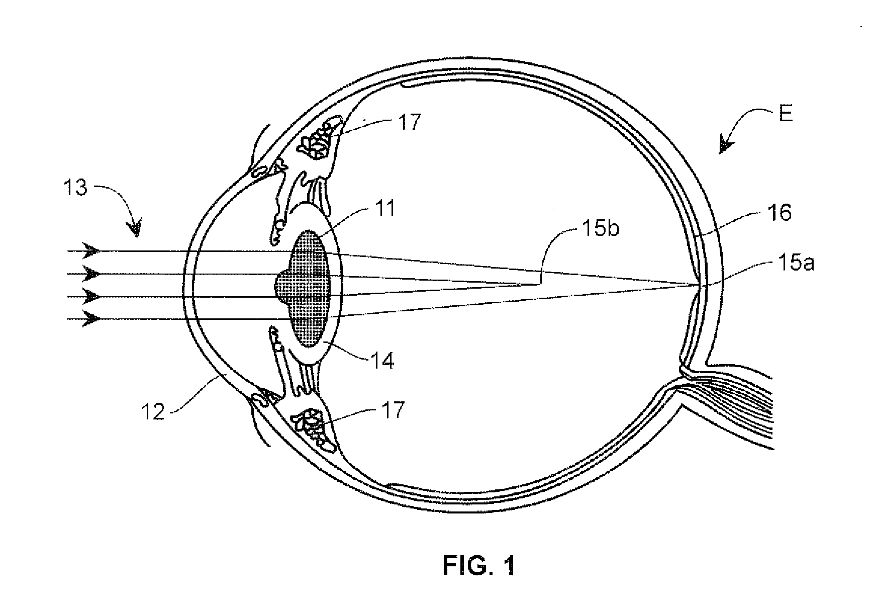 Lens providing extended depth of focus and method relating to same