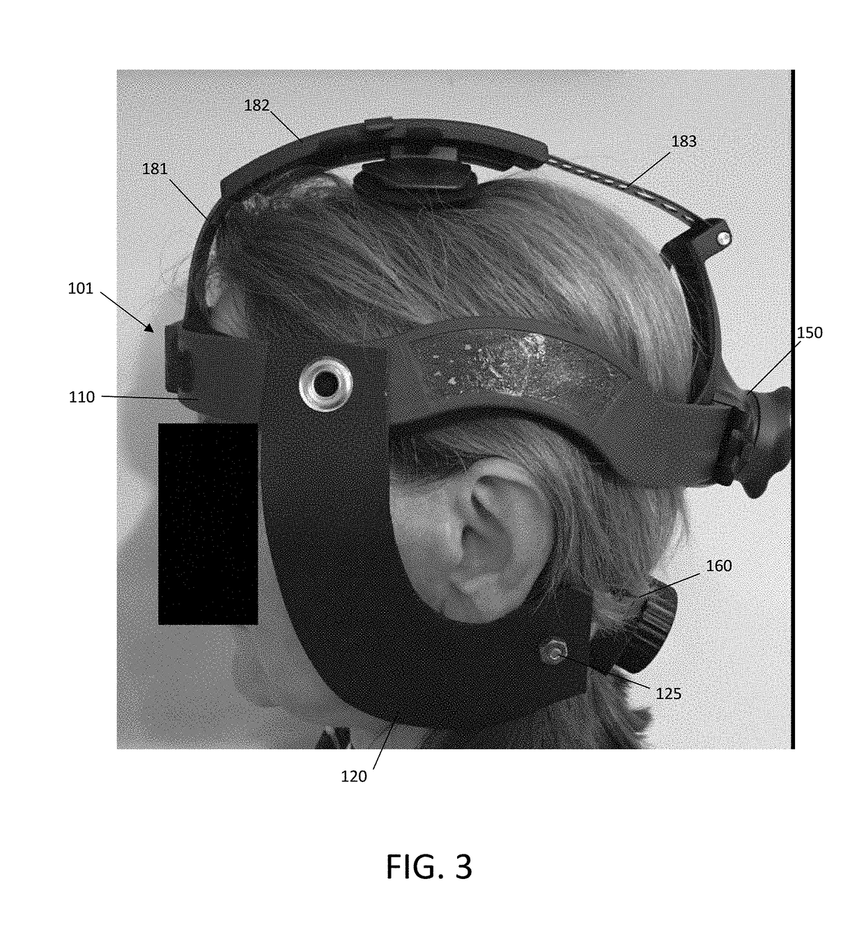 Adjustable mastoid dressing and method