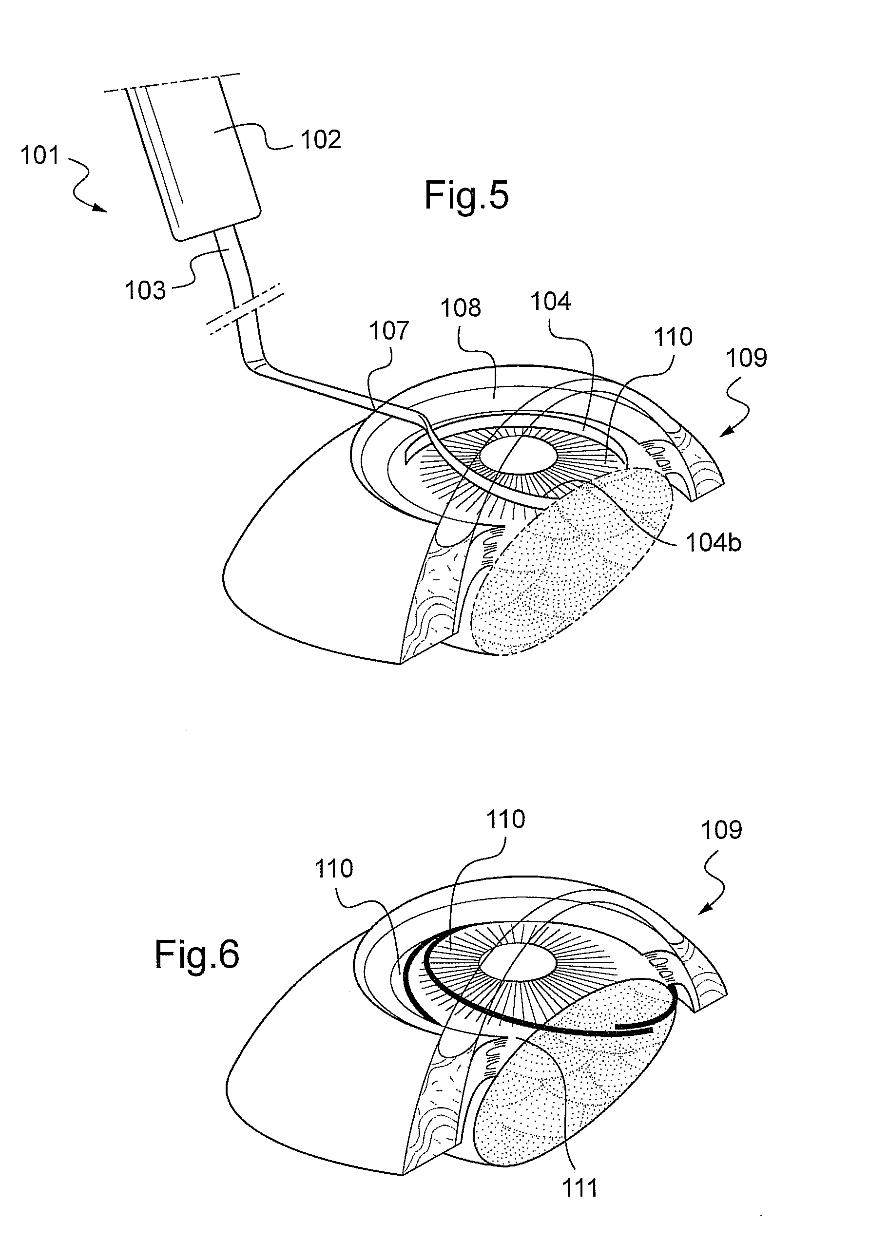 Ophthalmic surgery instrument