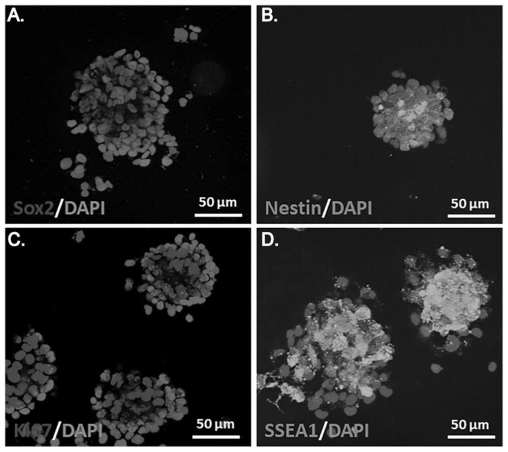 Preparation method and application of personalized induced neural stem cell exosome