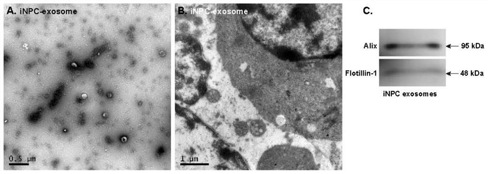 Preparation method and application of personalized induced neural stem cell exosome