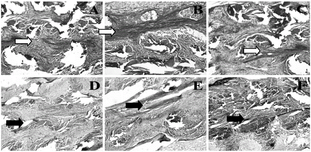 Method for staining hard tissue slices using picrosirius red and application of method