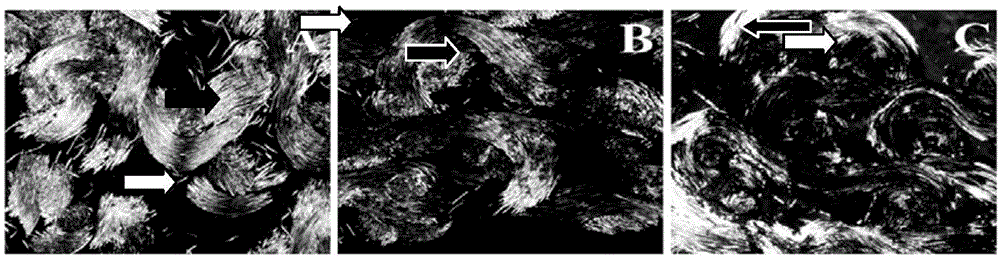 Method for staining hard tissue slices using picrosirius red and application of method