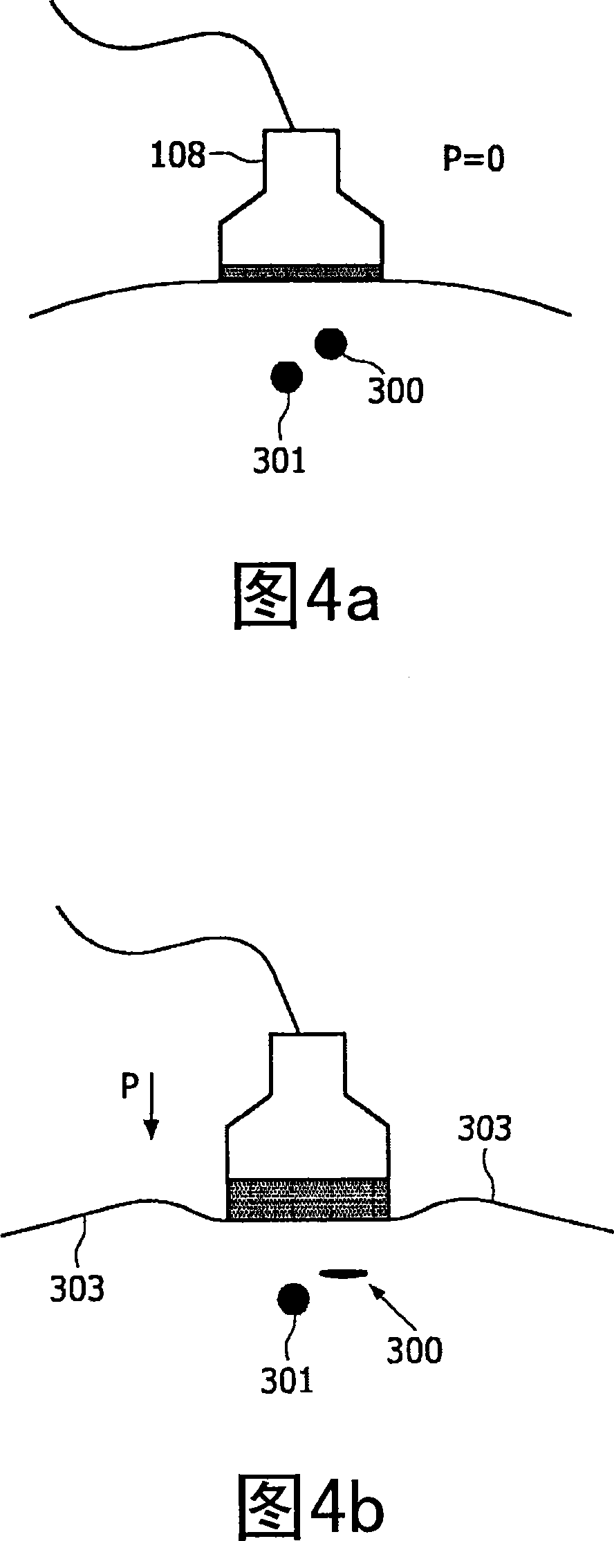 Cannula inserting system.