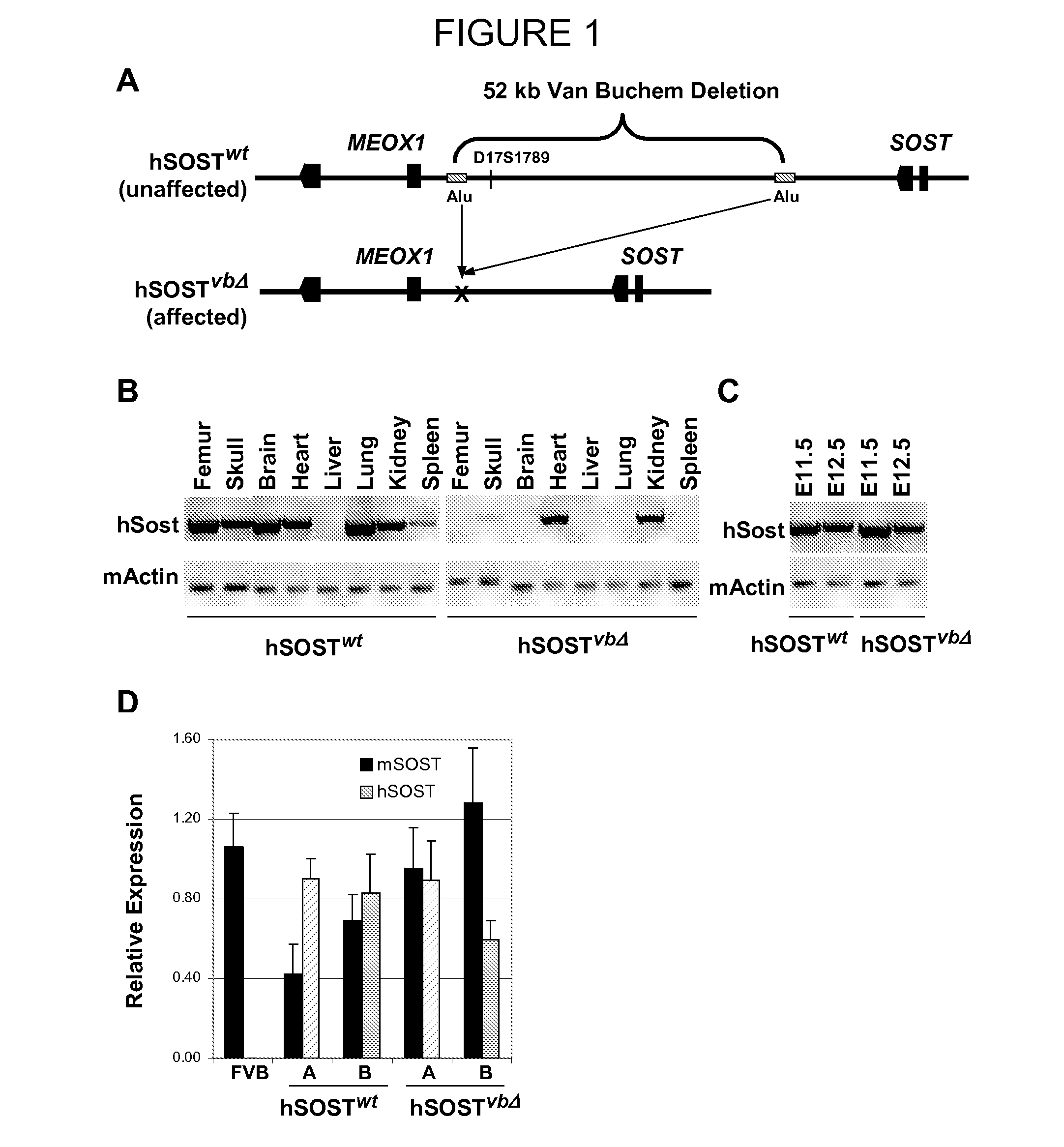 Compositions and methods for altering bone density and bone patterning