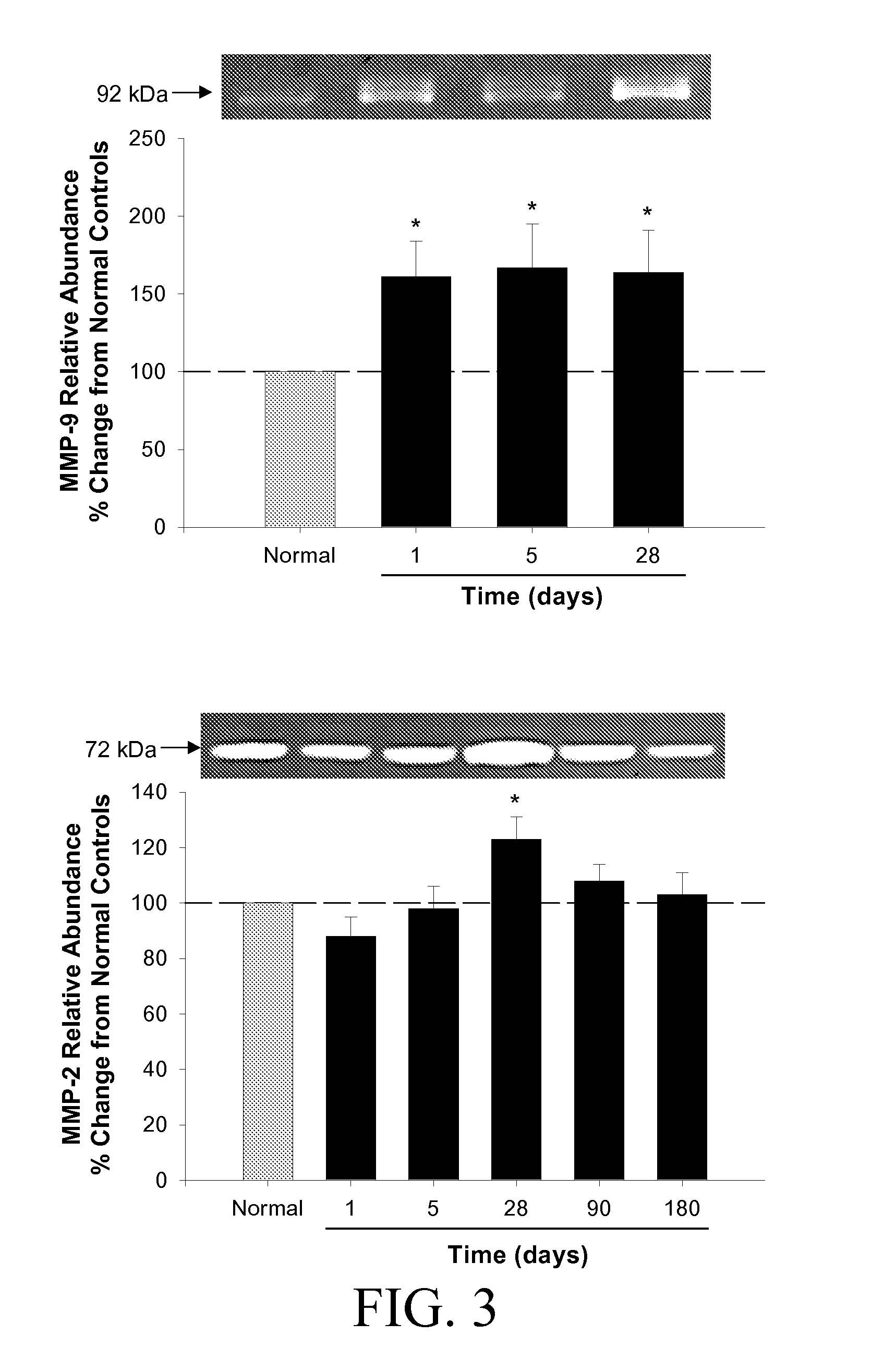 Predicting heart failure following myocardial infarction by protease and protease inhibitor profiling