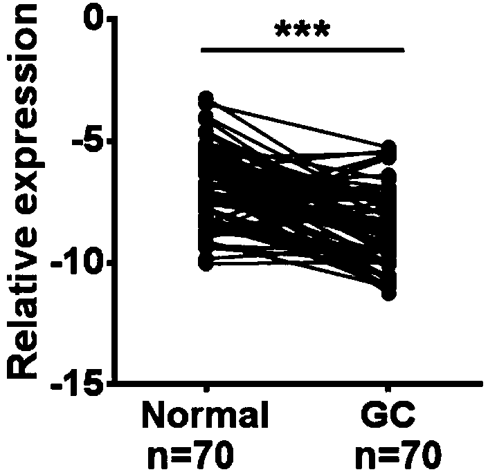 Application of lncRNA SGOL1-AS1 serving as marker for diagnosing stomach cancer